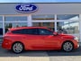 Ford Focus Wagon 1.0 EcoBoost Hybrid ST Line X | Private Lease Voorraad Actie €470,- pm obv 72 mnd / 5.000 km | Navigatie | Stoelverwarming | Achteruitrijcamera | AGR stoelen | Draadloos Carplay / Android auto