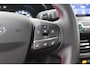Ford Focus Wagon 1.5 EcoBoost ST Line Business 181PK, CARPLAY | PANORAMADAK | RUIT/STOEL/STUURVERWARMING | TREKHAAK