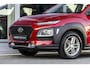 Hyundai Kona 1.0 T-GDI Comfort | Camera | Carplay