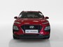 Hyundai Kona 1.0 TURBO | COMFORT | PLUS PACK | TREKHAAK | NL-AUTO |