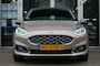 Ford Fiesta 1.0 ECOB. VIGNALE
