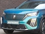 Peugeot 2008 SUV Allure 100pk | Parkeersensoren | Apple Carplay/Android Auto | DAB Radio