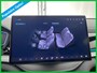 BYD Seal U 1.5 DM-i FWD Boost | Pano dak | Leer | 360 camera | El. achterklep | Memory stoel | Dodehoek detectie |