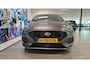Ford Fiesta 1.0 EcoBoost Hybrid ST-Line X