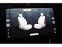 Land Rover Range Rover Velar 2.0 P400e R-Dynamic HSE / Acc / Lane Assist / Dode Hoek / 360 Camera / Memory / Meridian / Leder