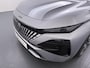 Peugeot 308 Allure | 360 Vision & Drive Assist Pack | Elektrische parkeerrem | Extra getinte achterste zijruiten en achterruit
