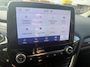 Ford Fiesta 1.0 EcoBoost Hybrid ST-Line X DAB | CARPLAY | STUUR/STOELVWERM. | CRUISE | CAMERA | CARPLAY |