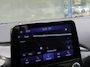 Ford Fiesta 1.0 EcoBoost Titanium X B&O Camera Carplay Dodehoek